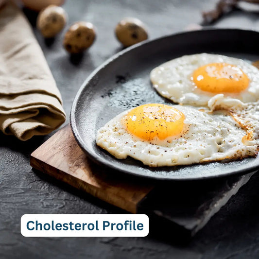 Cholesterol Lipid Profile London Medical Laboratory